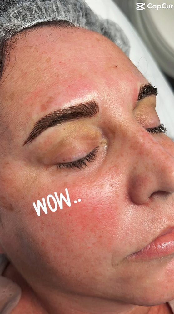 Freshly microbladed brows during a session at Roza Glam